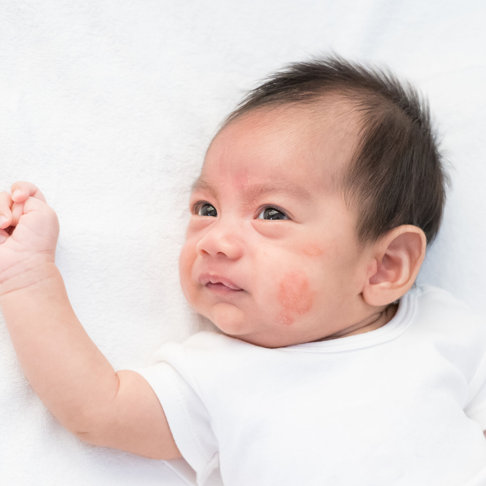 The best products for baby with dermatitis